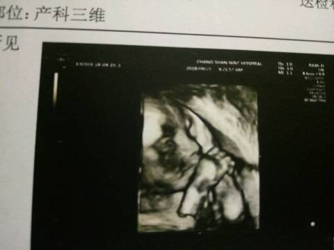 journal_insert_pic_1094494251