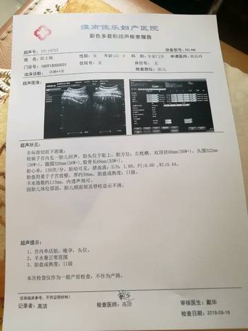 journal_insert_pic_1095073481