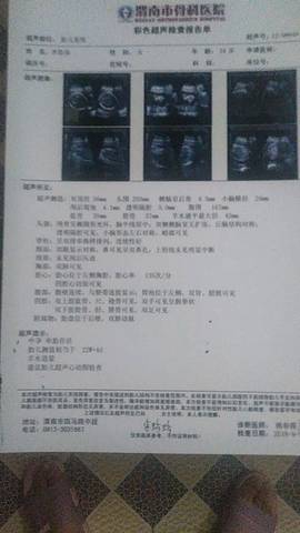 journal_insert_pic_1095282562