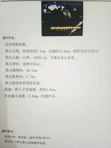 journal_insert_pic_1095645496