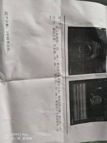 journal_insert_pic_1095792965