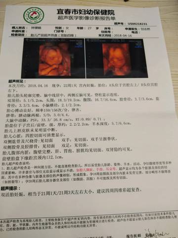 journal_insert_pic_1096215469