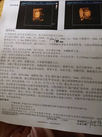journal_insert_pic_1096266357