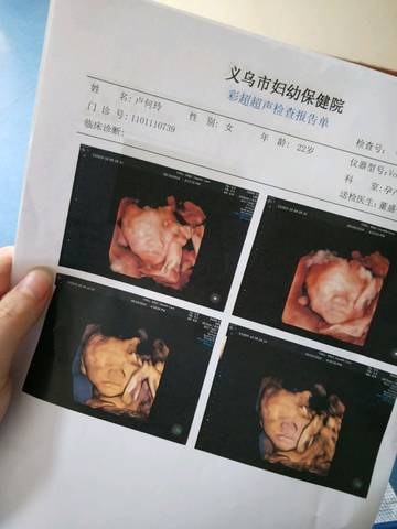 journal_insert_pic_1096308243