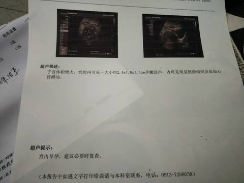 journal_insert_pic_1096203112