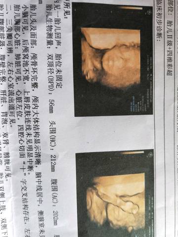 journal_insert_pic_1096219534
