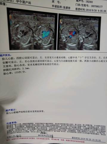 journal_insert_pic_1096325562