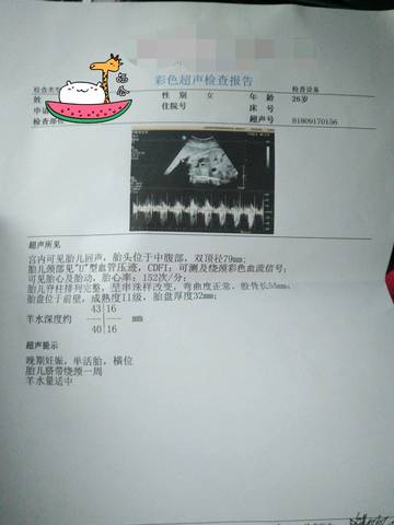 journal_insert_pic_1097637512