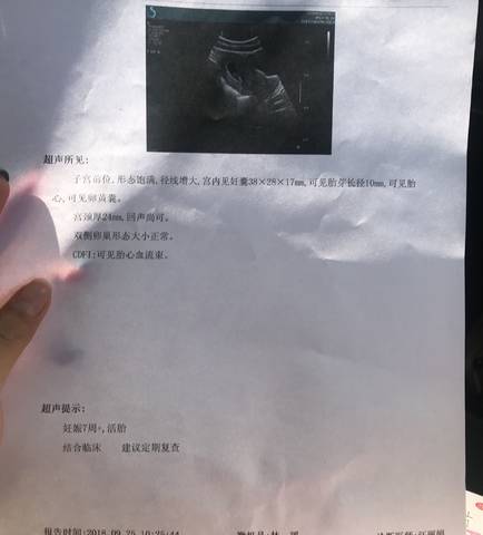 journal_insert_pic_1099046045