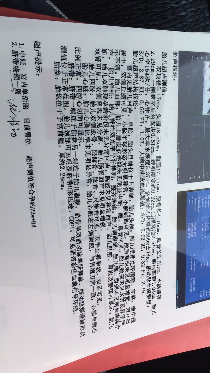还愿啦，四维顺利通过