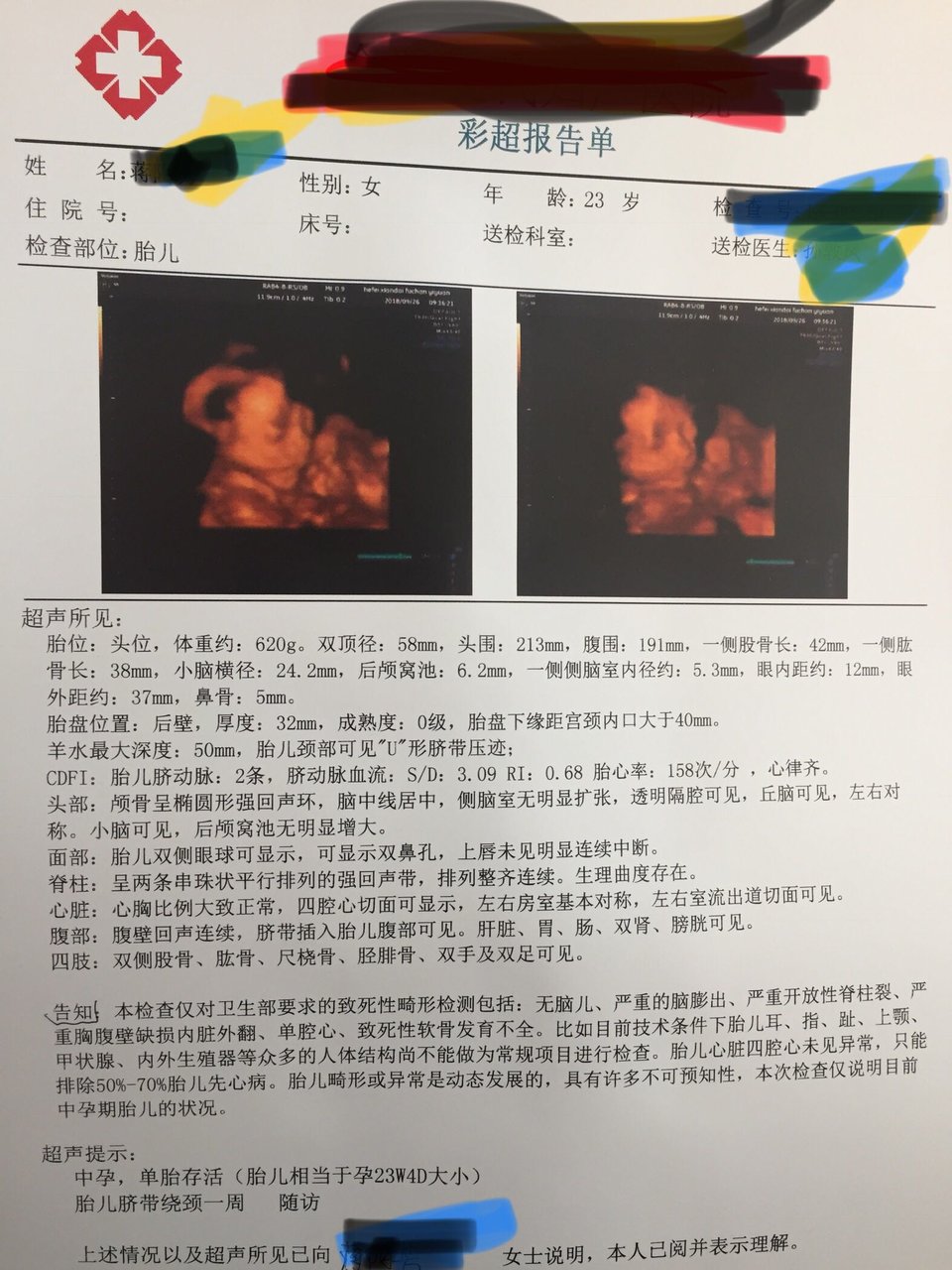 四维，四维，顺利，顺利，通过！😚😚