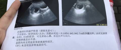 journal_insert_pic_1100532539