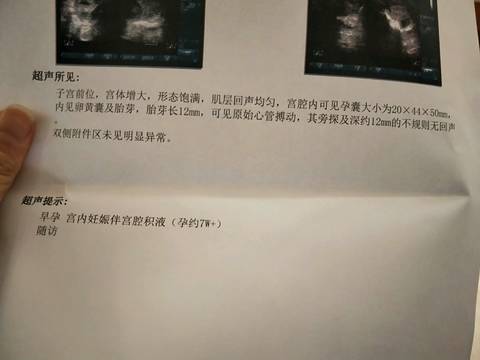 journal_insert_pic_1101569713