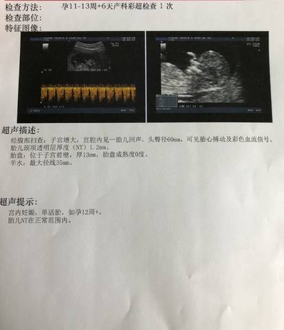 journal_insert_pic_1101624975