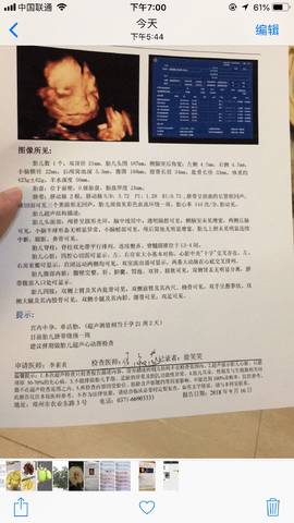 journal_insert_pic_1102292049