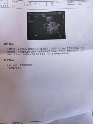 journal_insert_pic_1103190599
