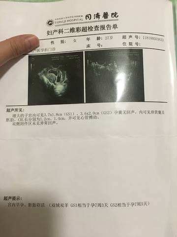 journal_insert_pic_1105585003