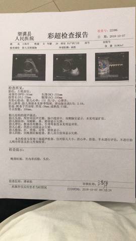 journal_insert_pic_1106810451
