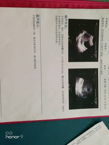 journal_insert_pic_1107014602