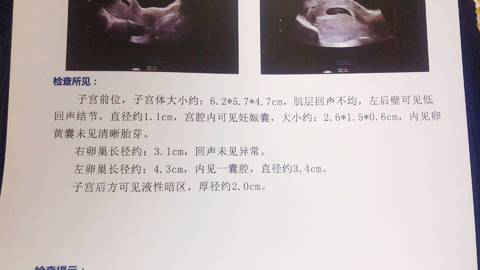 journal_insert_pic_1107953305