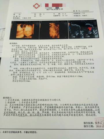 journal_insert_pic_1107836218