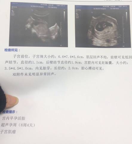 journal_insert_pic_1107953314