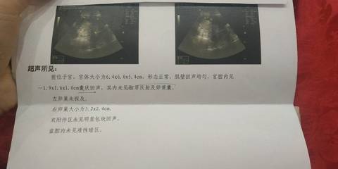 journal_insert_pic_1109403799