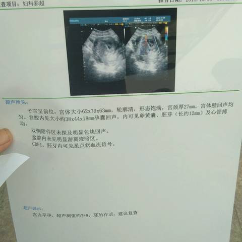 journal_insert_pic_1110377182