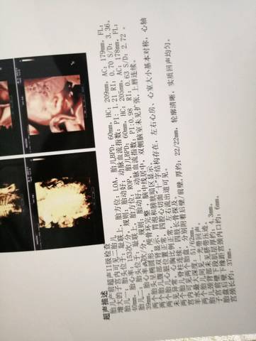 journal_insert_pic_1112162497