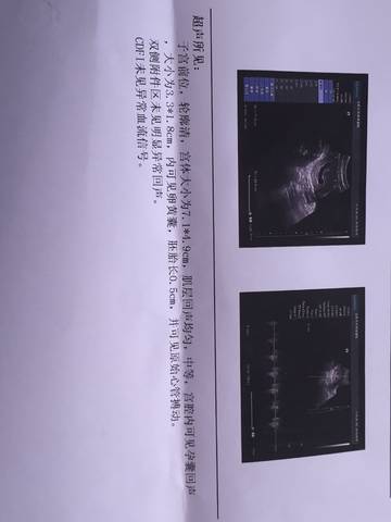 journal_insert_pic_1112069831