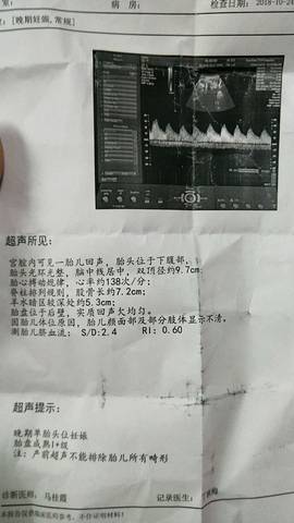journal_insert_pic_1117719671