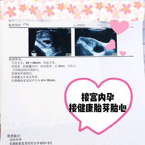 journal_insert_pic_1121004411