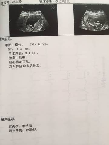 journal_insert_pic_1125152524