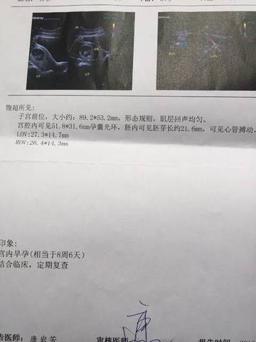 journal_insert_pic_1125365686