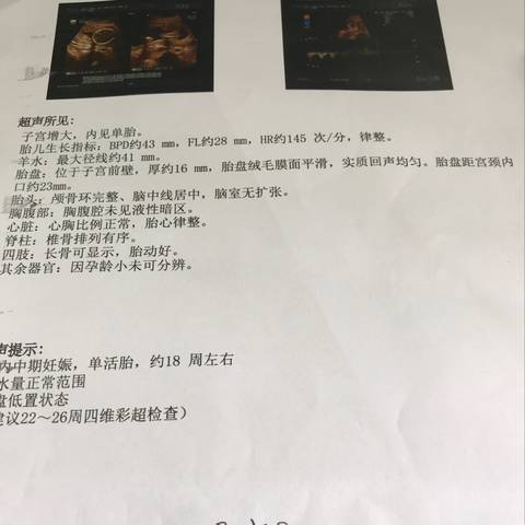 journal_insert_pic_1125672257