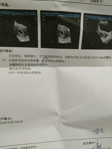 journal_insert_pic_1127323655