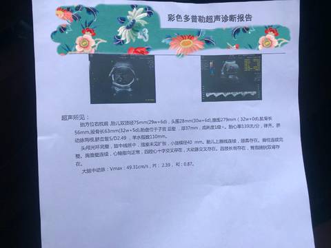 journal_insert_pic_1128330055