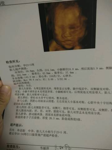 journal_insert_pic_1129207555