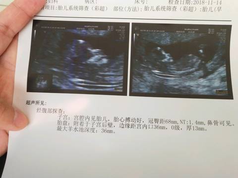 journal_insert_pic_1129601742
