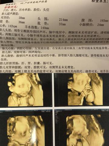 journal_insert_pic_1129937099