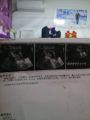 journal_insert_pic_1130386308