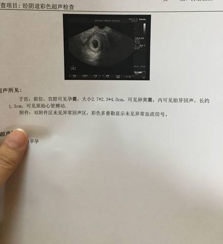 journal_insert_pic_1130450956