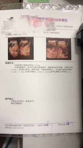journal_insert_pic_1132783296