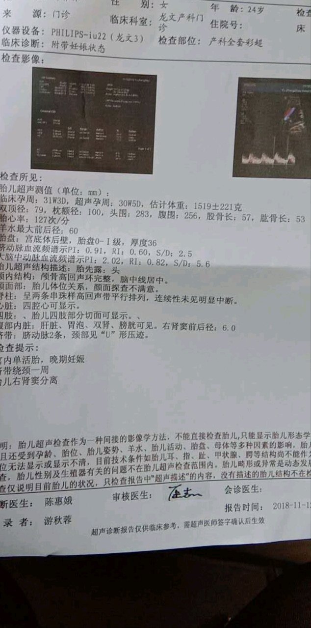 有谁知道右肾窦分离这样正常吗？