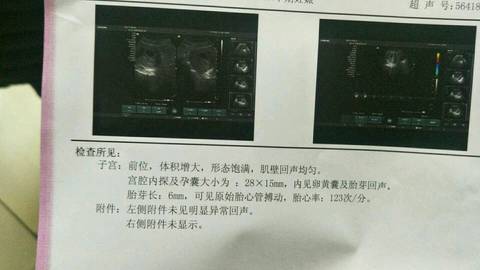 journal_insert_pic_1134840324