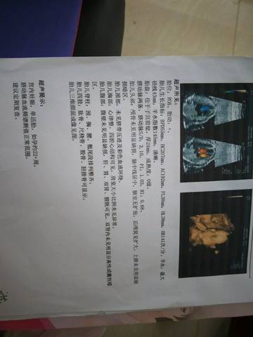 journal_insert_pic_1135021204