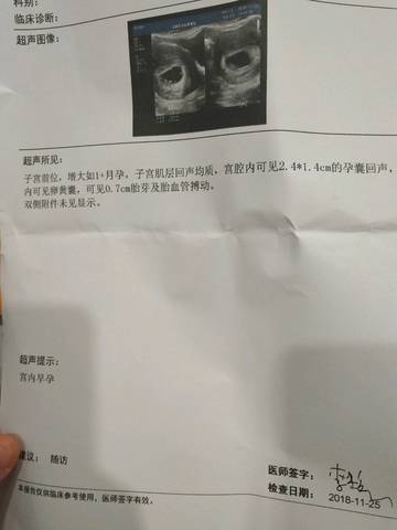 journal_insert_pic_1136630794