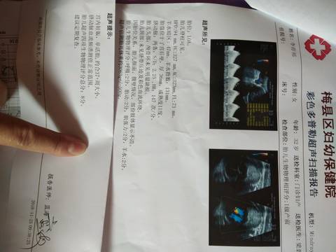 journal_insert_pic_1136363961