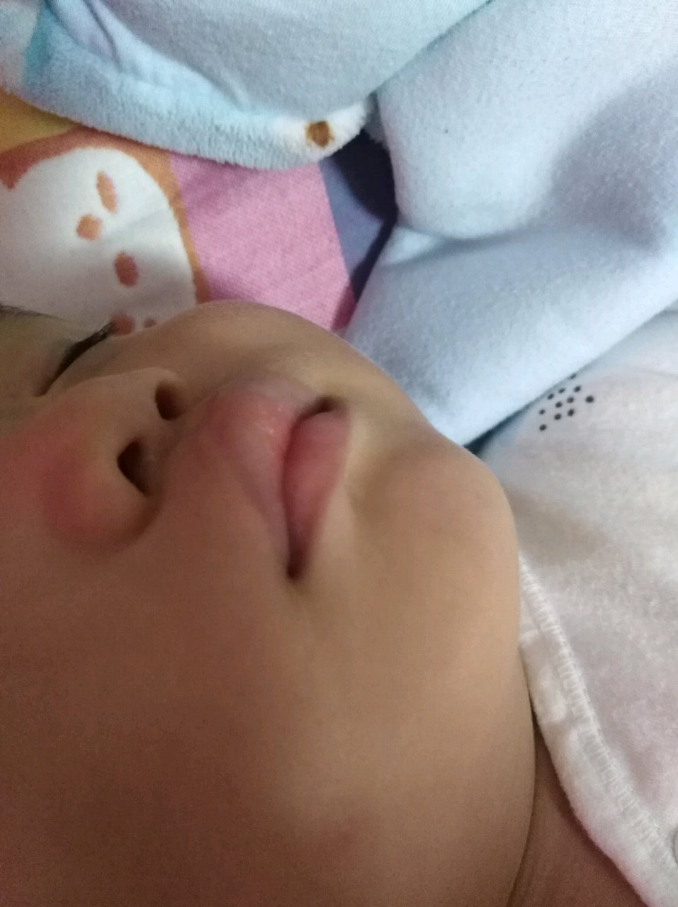 宝宝上嘴唇起一片小泡泡