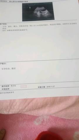 journal_insert_pic_1138257804